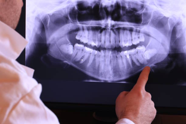 Best Broken or Cracked Tooth Emergency Dentist in Lakeside Park, KY